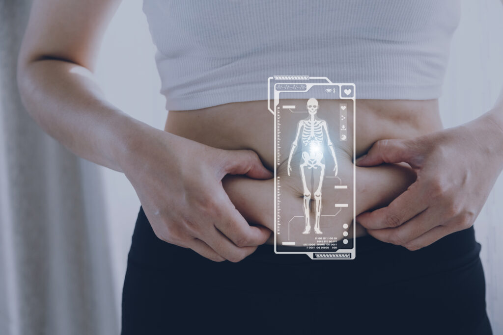 weight loss management support